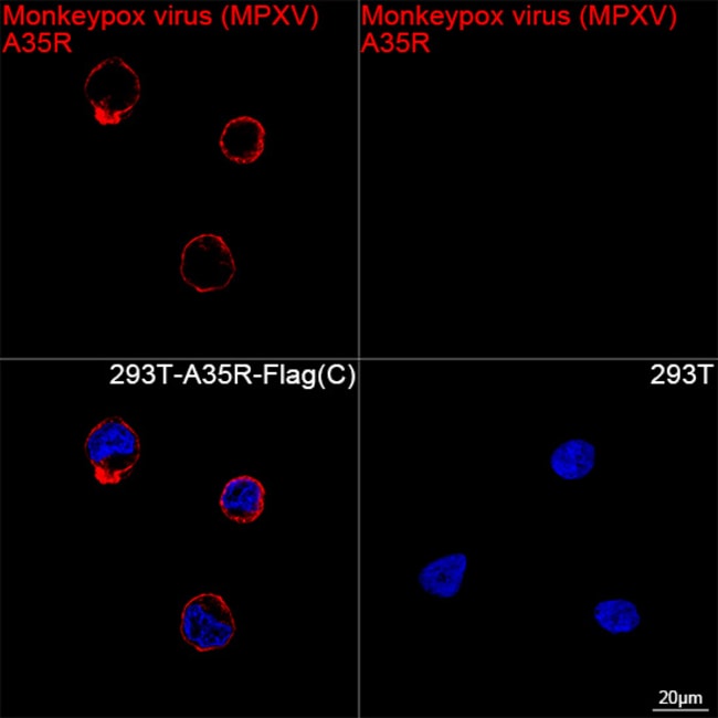 MONKEYPOX VIRUS A35R RMAB 100 UL