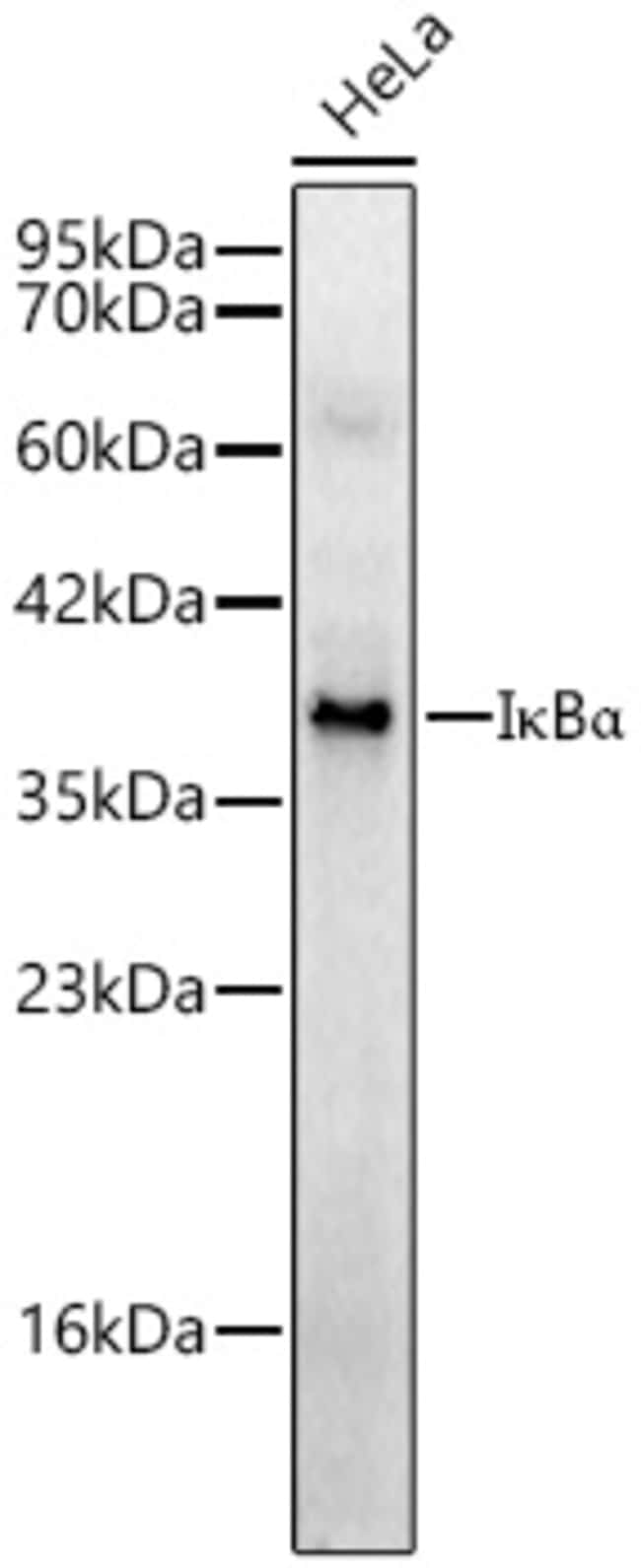 IKB ALPHA RMAB 100 UL