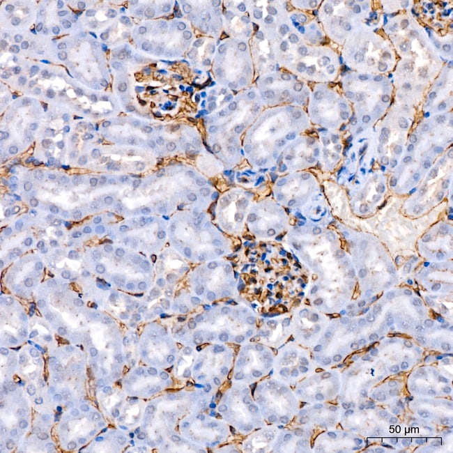ENDOMUCIN RMAB 100 UL