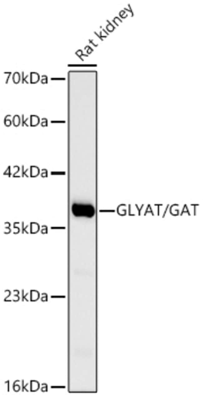 GLYAT RMAB 100 UL