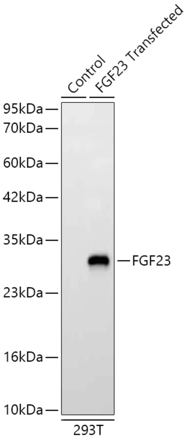 FGF23 RMAB 100 UL