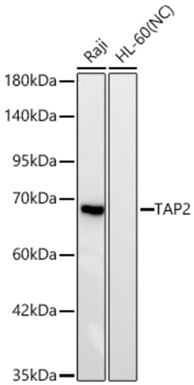 TAP2 RMAB 20 UL