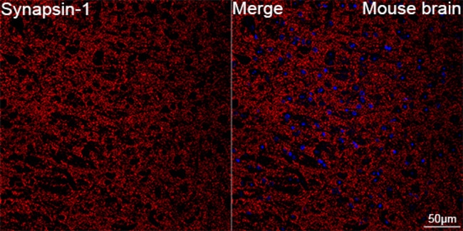 SYNAPSIN 1 RMAB 100 UL