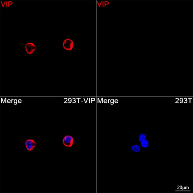 VIP RMAB 100 UL