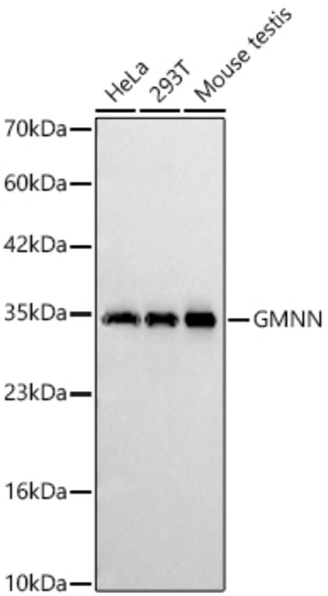 GMNN RMAB 100 UL