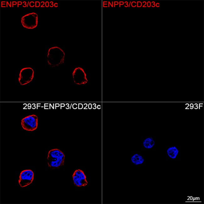 CD203C RMAB 100 UL