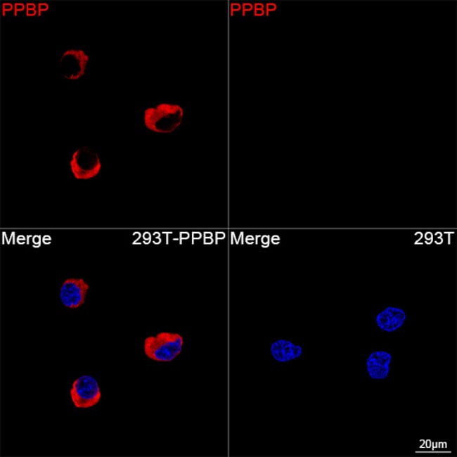 PPBP RMAB 100 UL
