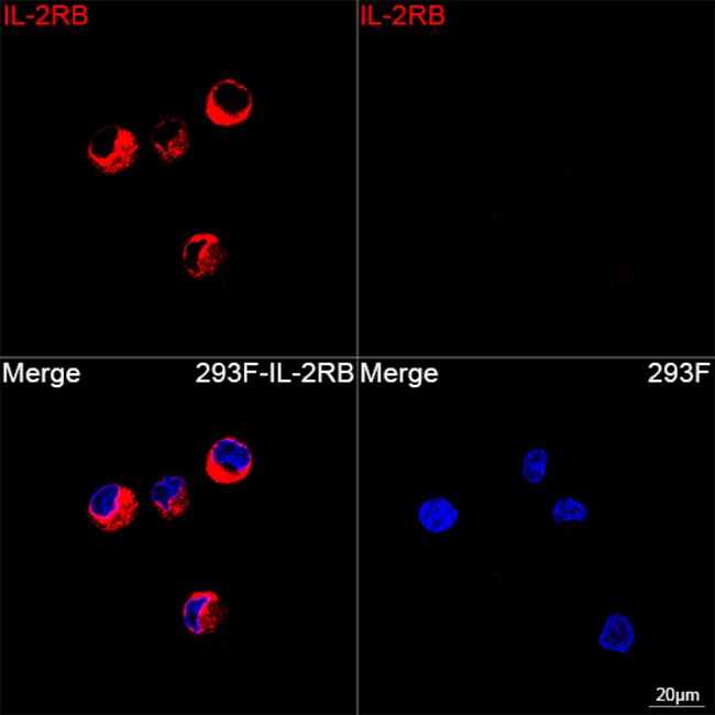 CD122 RMAB 100 UL
