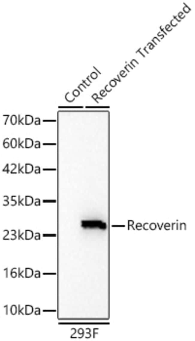 RECOVERIN RMAB 100 UL