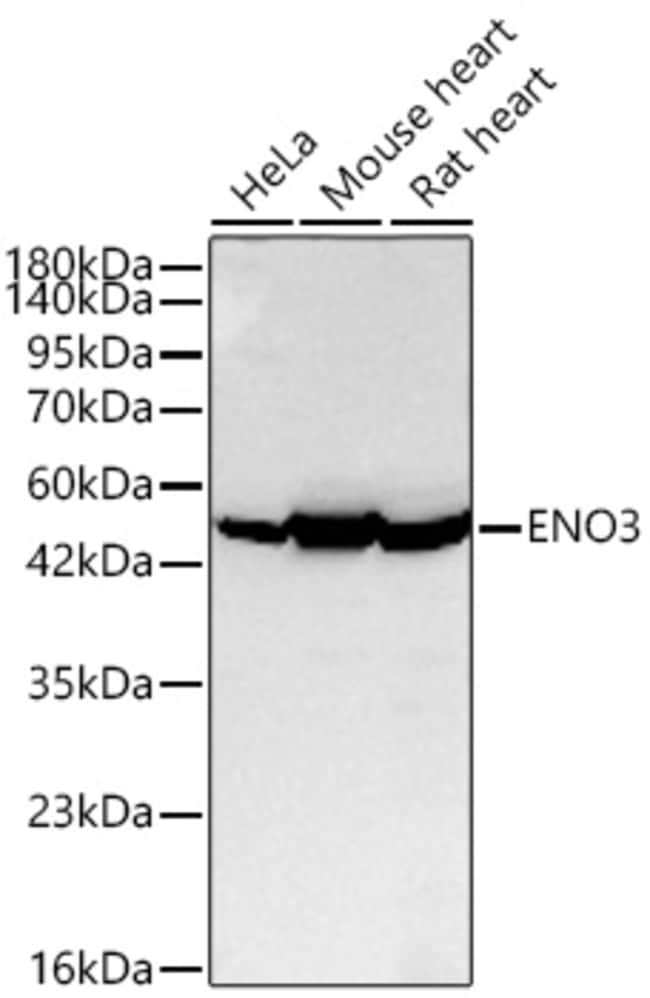 ENO3 RMAB 100 UL