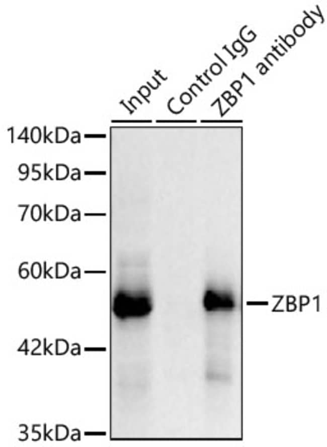 ZBP1 RMAB 100 UL