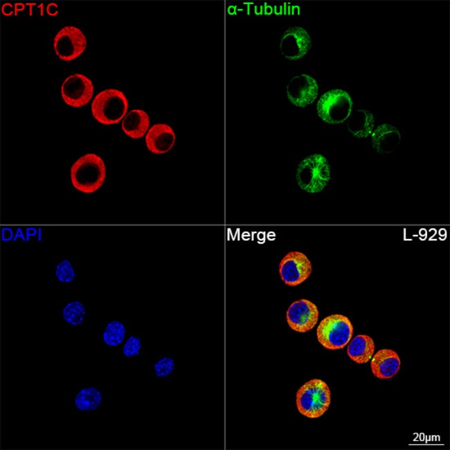 CPT1C RMAB 100 UL