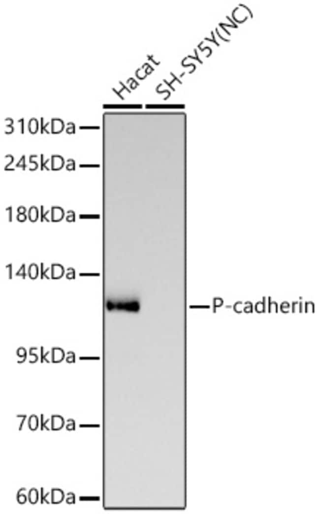 P-CADHERIN RMAB 100 UL