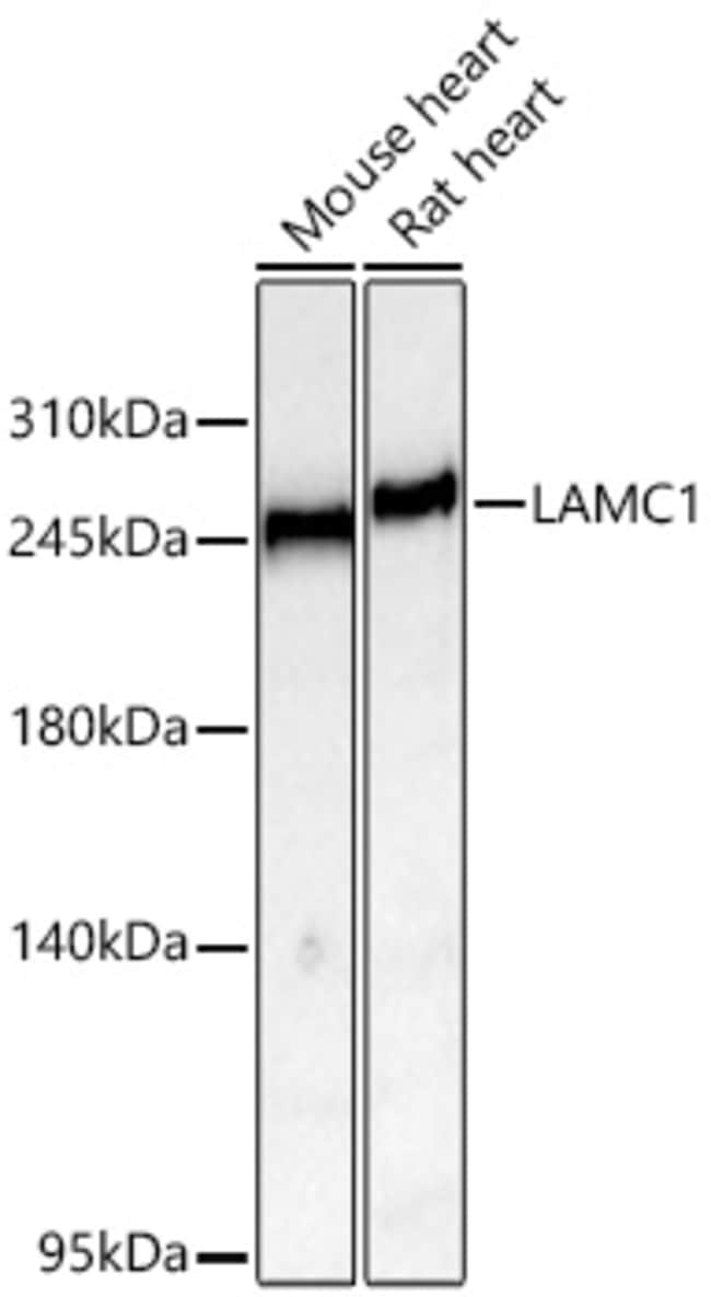 LAMININ GAMMA-1 RMAB 100 UL