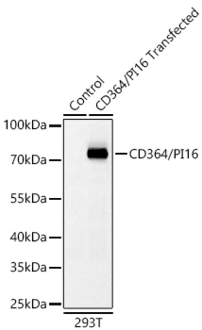 PI16 RMAB 100 UL