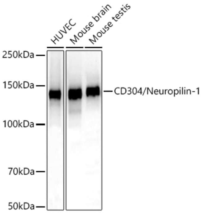 NEUROPILIN 1 RMAB 100 UL