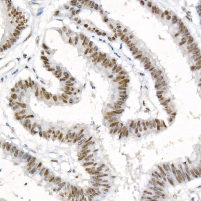 DNA-PK RMAB 100 UL
