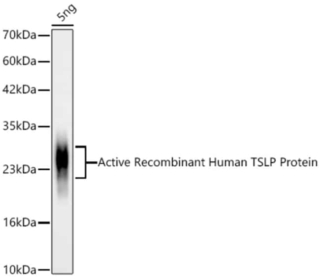 TSLP RMAB 100 UL