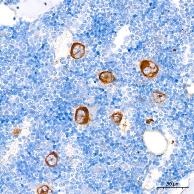 TGF BETA-1 RMAB 100 UL