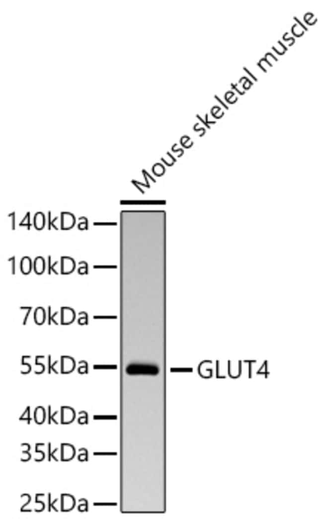 GLUT4 RMAB 100 UL