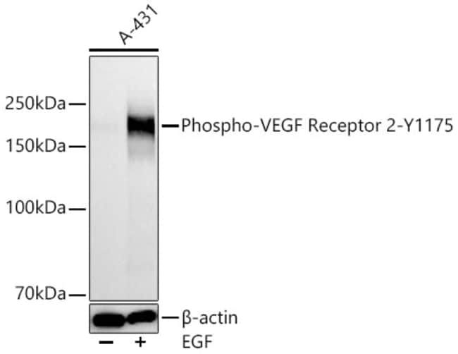 PHOSPHO-VEGF RECEPTOR 2 ( RMAB 100 UL