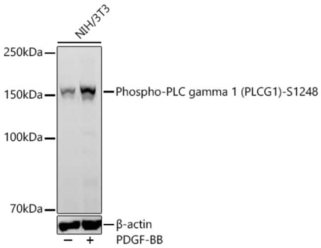 PHOSPHO-PLCG1 (SER1248) RMAB 100UL