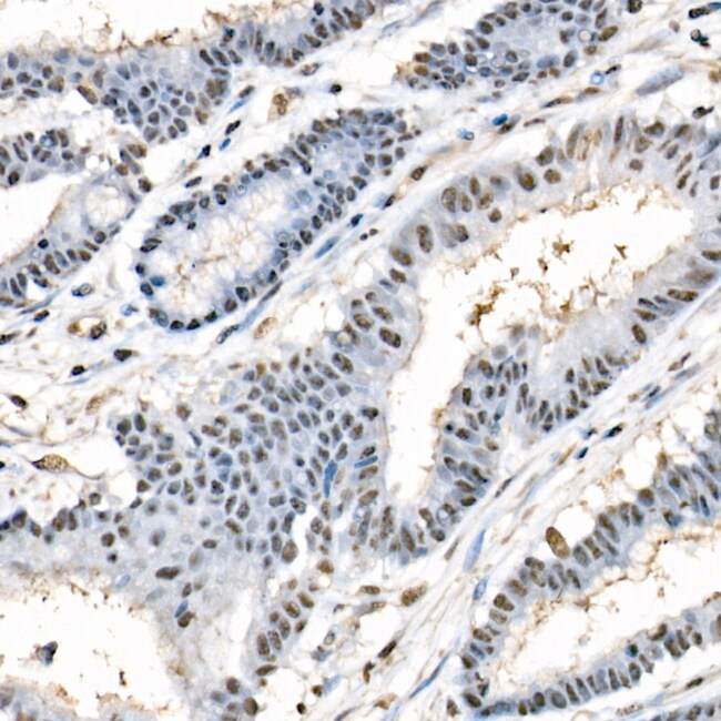 PHOSPHO-BECLIN 1 (SER90) RMAB 100 UL