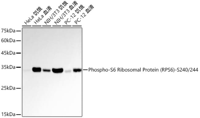 PHOSPHO-S6 RIBOSOMAL PROT RMAB 100 UL