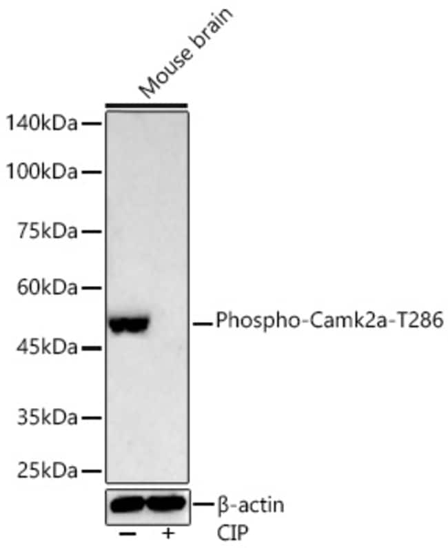 PHOSPHO-CAMKII ALPHA (THR RMAB 100 UL