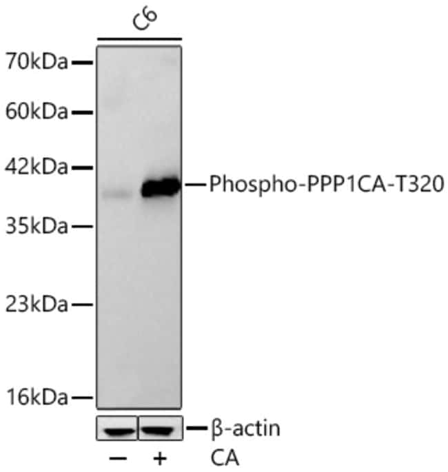 PHOSPHO-PP1 ALPHA (THR320 RMAB 100 UL