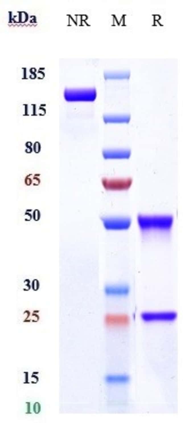 CD205 BIOSIMILAR RMAB 1 MG