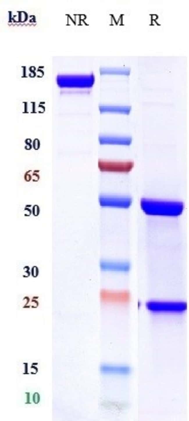 TIGATUZUMAB RMAB 1 MG