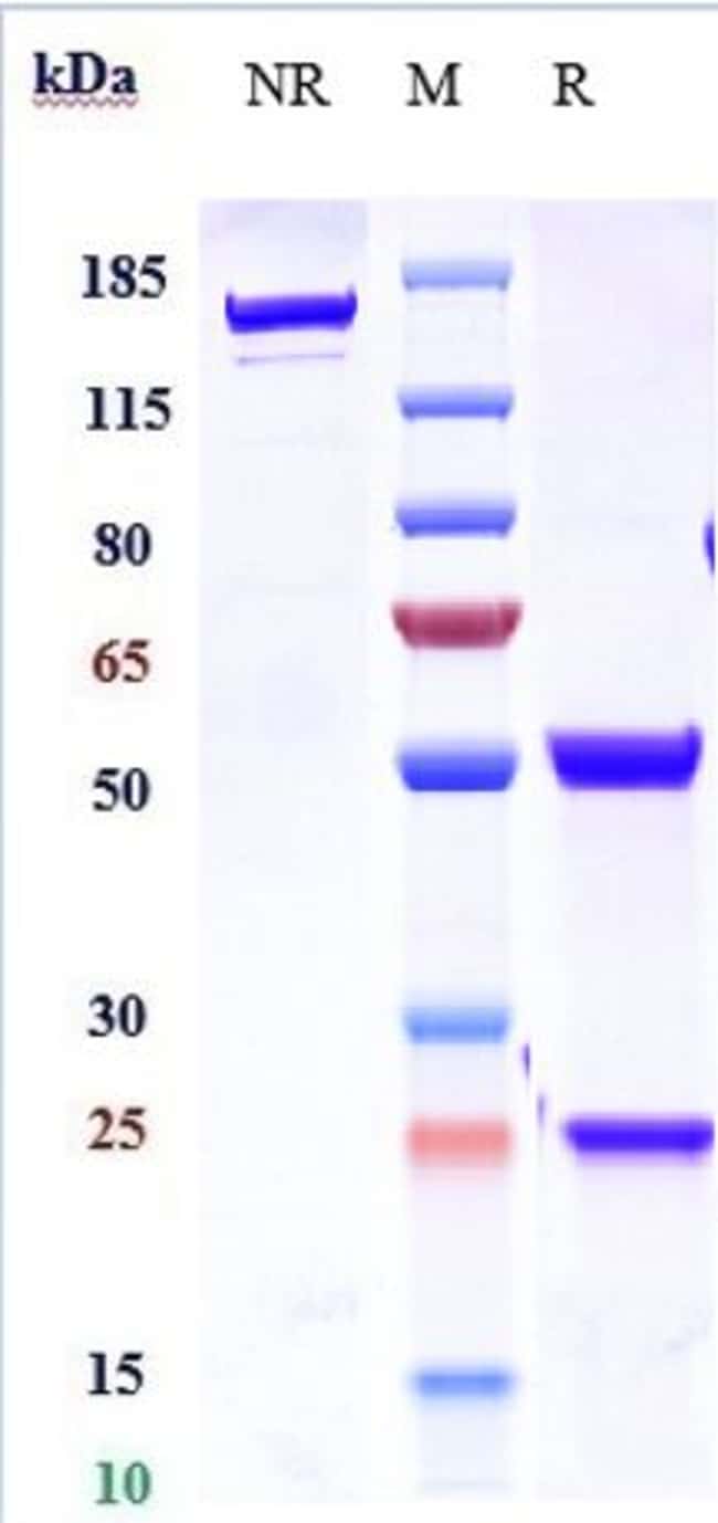IL-21 BIOSIMILAR RMAB 1 MG