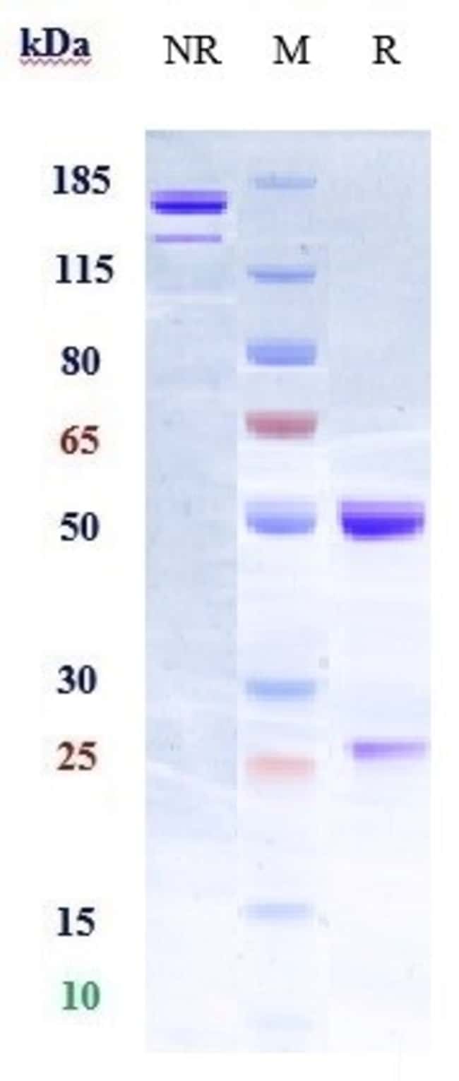 ELEZANUMAB RMAB 1 MG