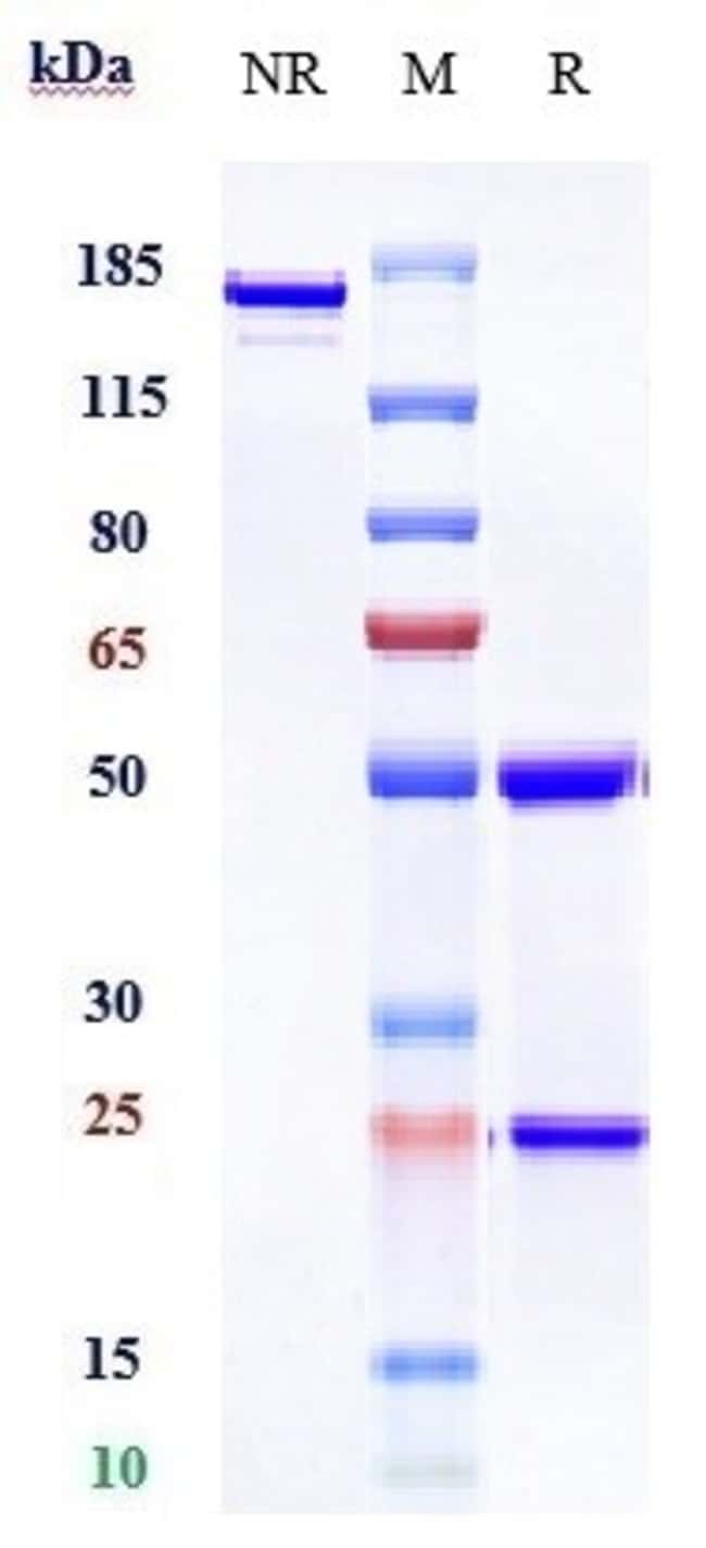 SIGLEC15 BIOSIMILAR RMAB 1 MG