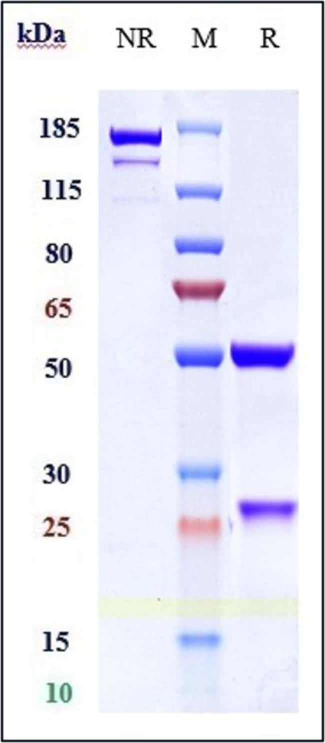 CD166 (ALCAM) BIOSIMILAR RMAB 1 MG