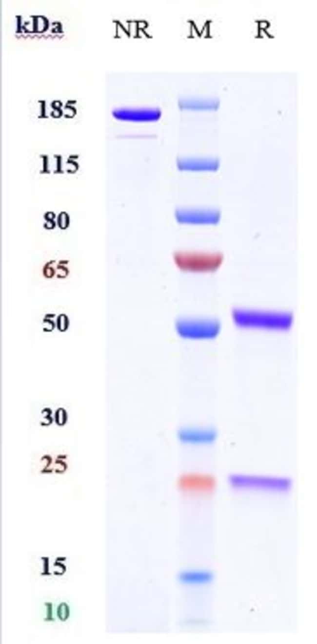 DEZAMIZUMAB RMAB 1 MG