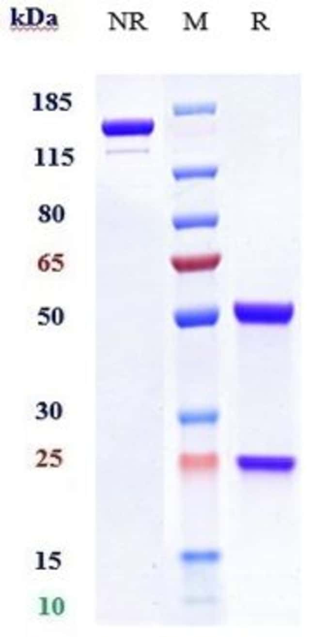 GIRENTUXIMAB RMAB 1 MG