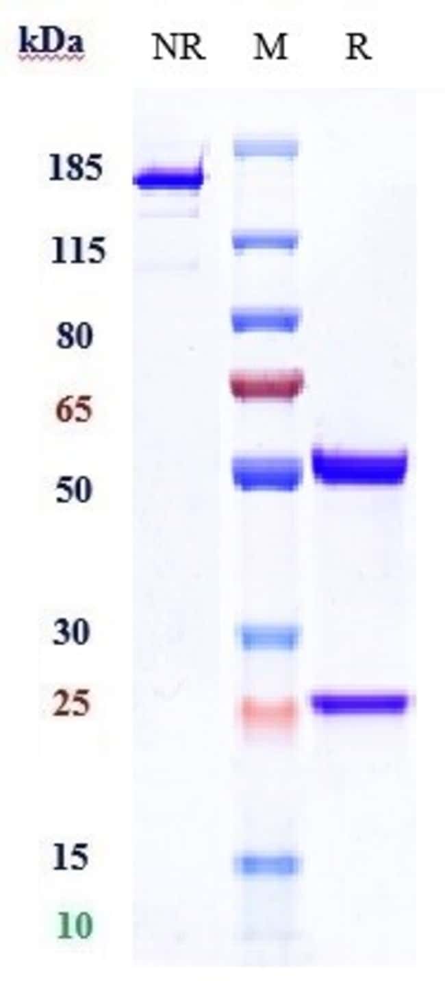 CATHEPSIN S BIOSIMILAR RMAB 1 MG