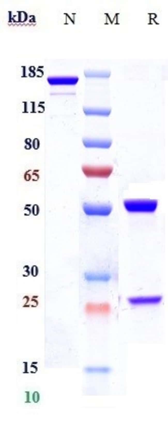 PLOZALIZUMAB RMAB 1 MG