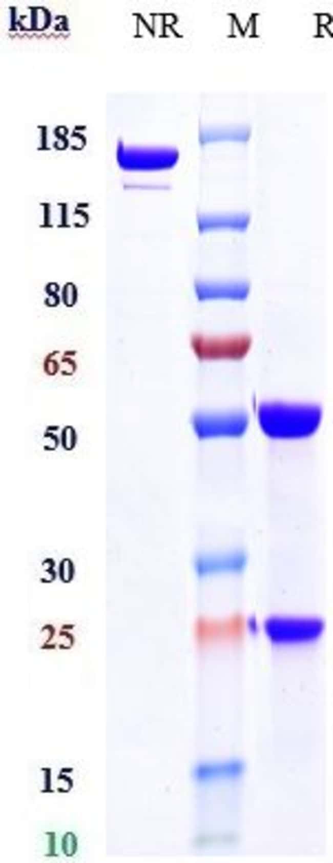 ALEMTUZUMAB RMAB 1 MG