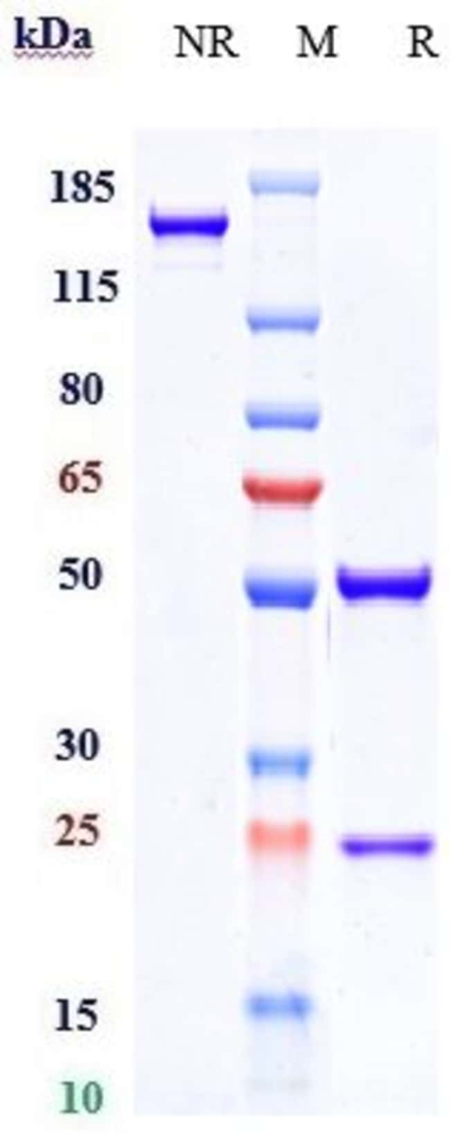 ELDELUMAB RMAB 1 MG