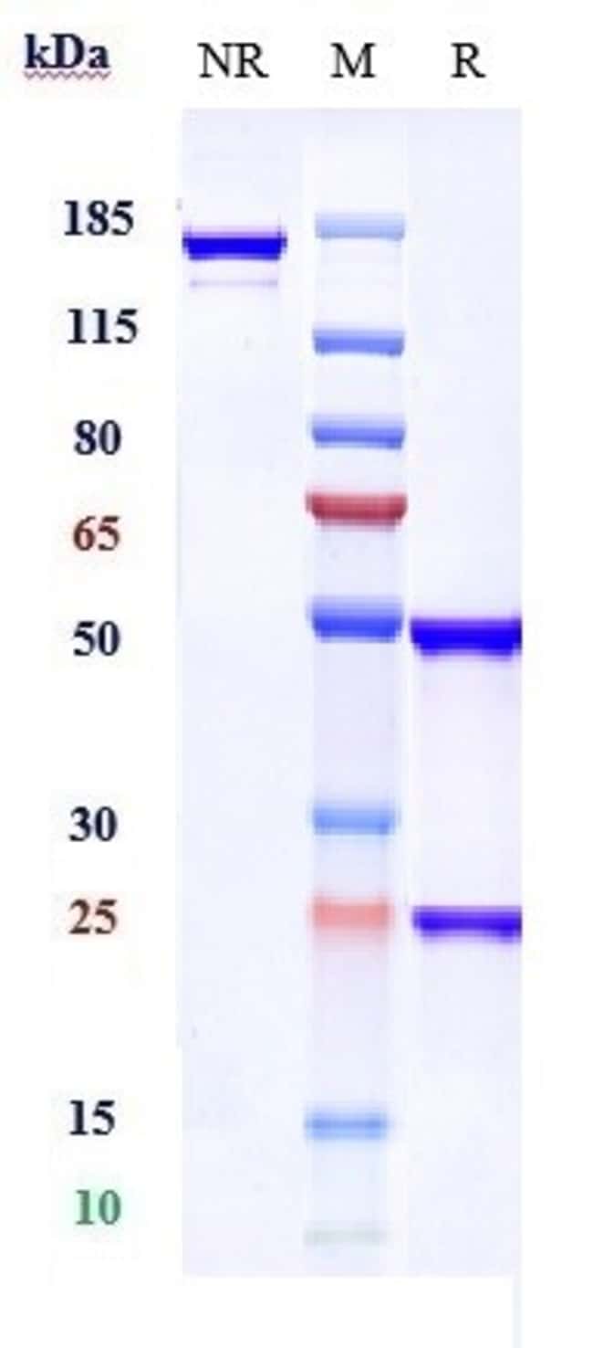 CXCL9 (MIG) BIOSIMILAR RMAB 1 MG