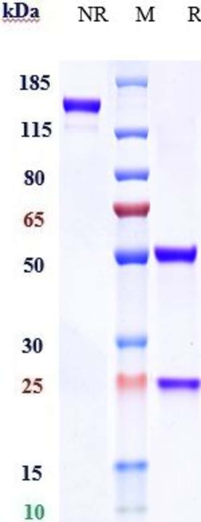 DC-SIGN (CD209) BIOSIMILA RMAB 100 UG
