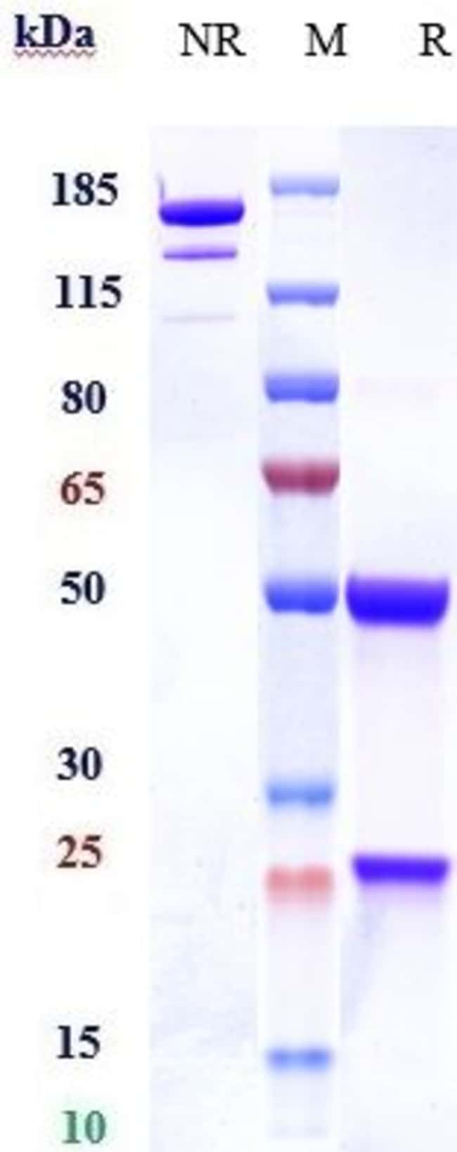 DECTIN 1 (CLEC7A) BIOSIMI RMAB 100 UG