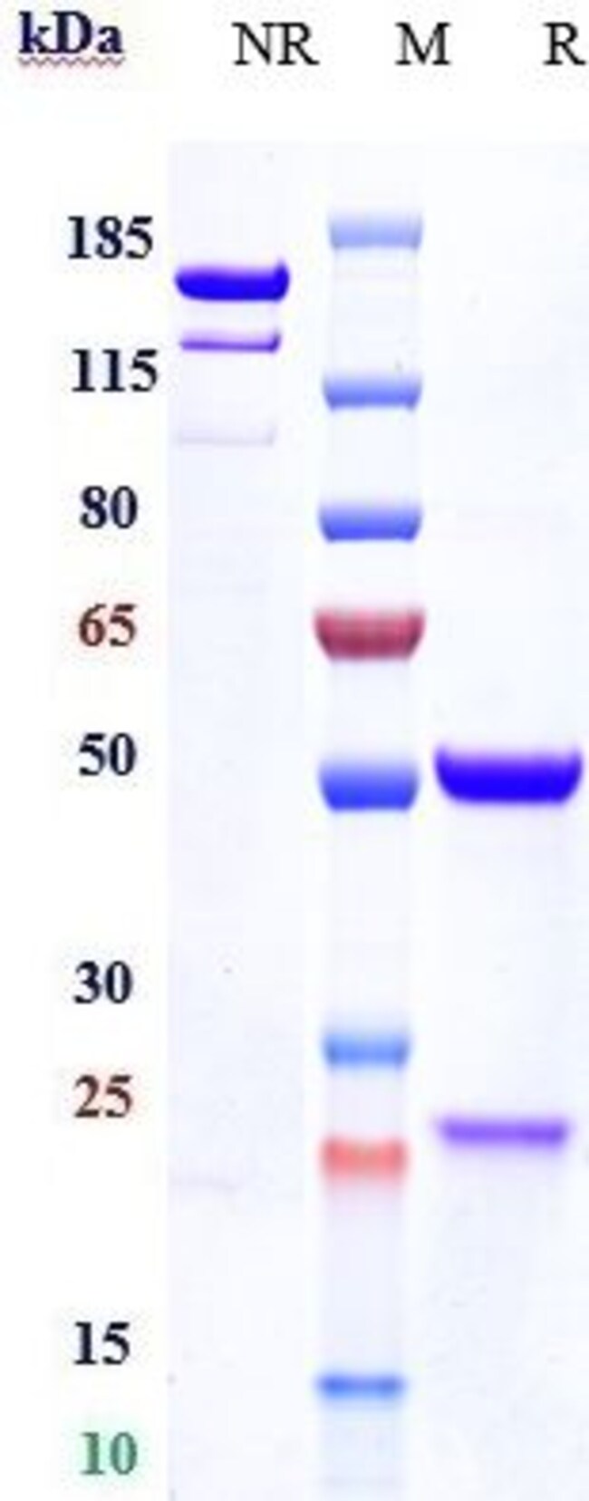 DKK1 BIOSIMILAR RMAB 1 MG