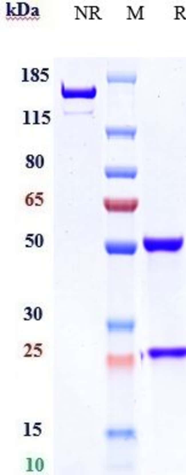 EPHB4 BIOSIMILAR RMAB 1 MG