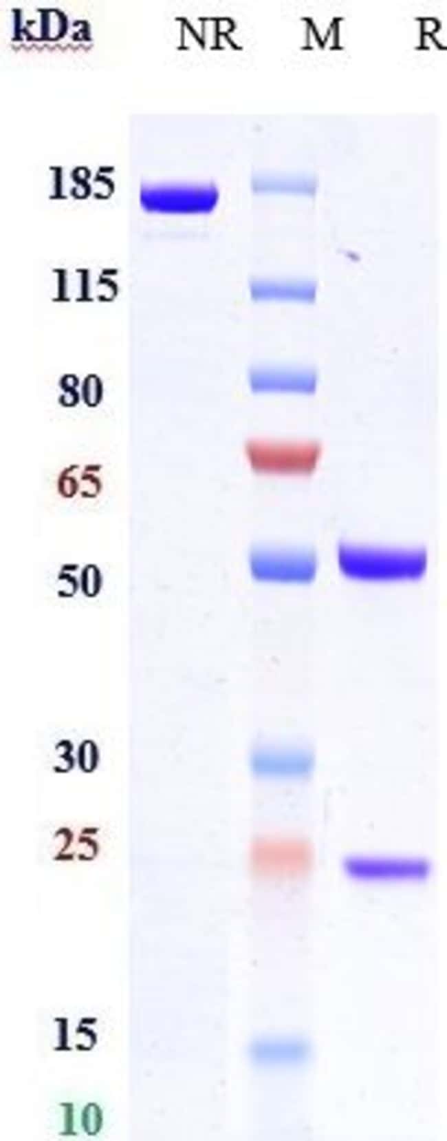 FZD7 BIOSIMILAR RMAB 1 MG