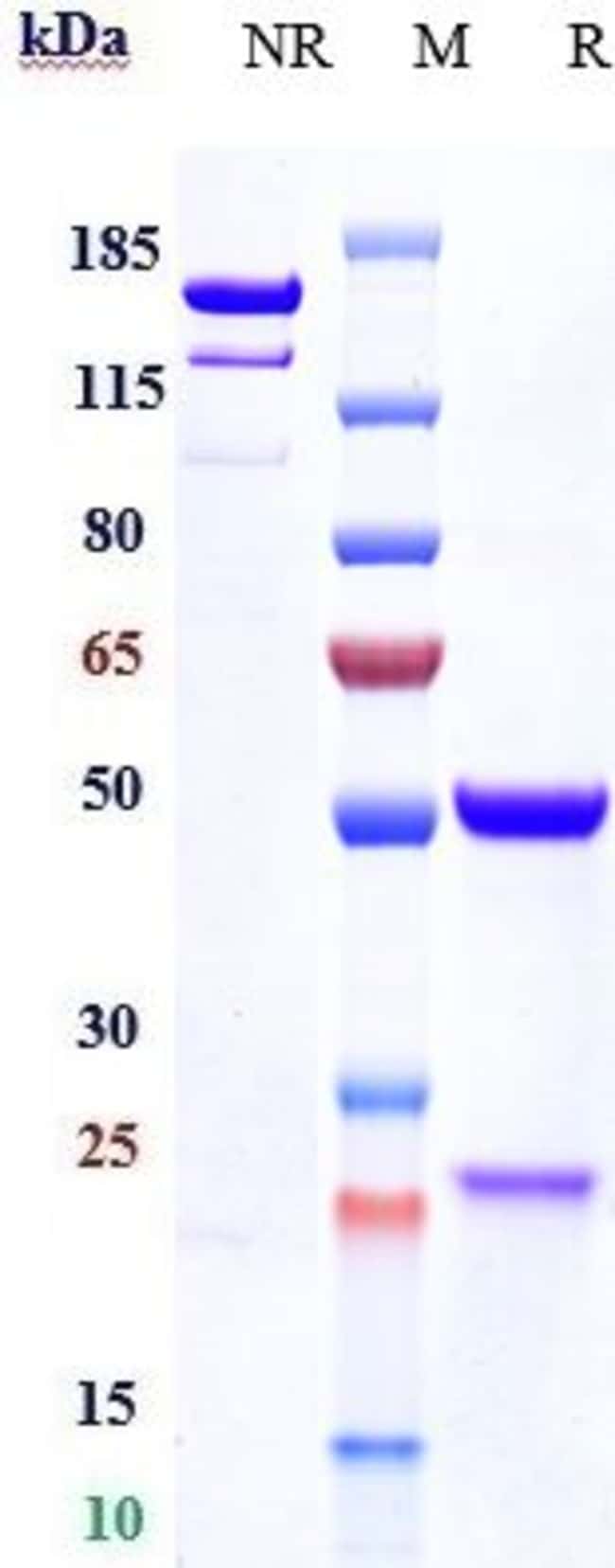 HAPTOGLOBIN BIOSIMILAR RMAB 1 MG