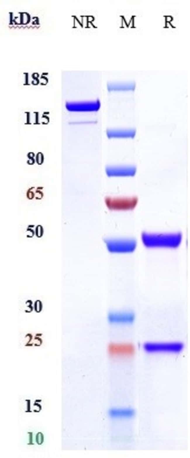 ANRUKINZUMAB RMAB 1 MG